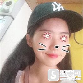 姜民范医生有怎样的技术实力?做的下颌角手术果怎么样?案例分享。