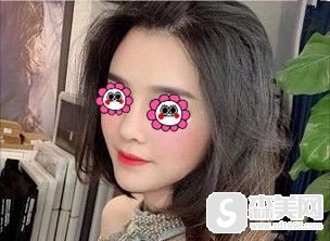 河南中医药大学第一附属医院好不好?做的隆鼻手术让我有哪些改变?