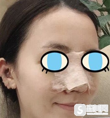 北京明星去的整容医院是哪一家做出名?北京八大处的口碑技术怎么样?