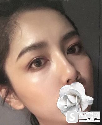 北京明星去的整容医院是哪一家做出名?北京八大处的口碑技术怎么样?