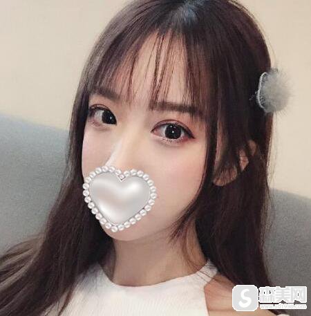 汕头华美医疗整形医院怎么样?附双眼皮案例分享