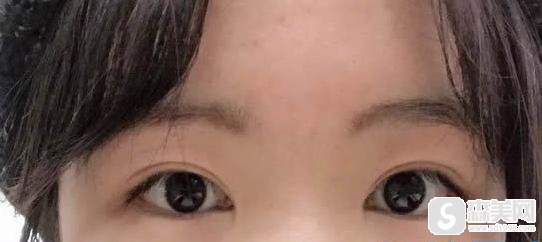 安徽合肥韩美整形医院怎么样？附双眼皮案例分享