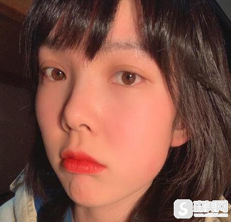 光子嫩肤的原理是什么？附光子嫩肤案例分享