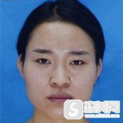 八大处吕长胜的技术实力好吗?改脸型的手术做的怎么样?