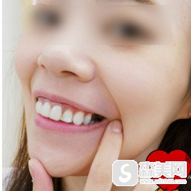 做种植牙不好?武汉爱齿尔口腔田虎的案例让你嫉妒