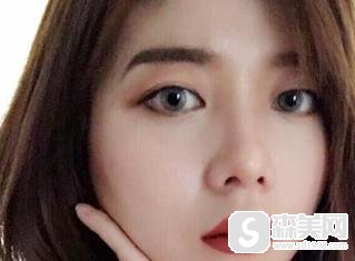 鼻翼缩小整容怎么样?附鼻翼缩小案例分享