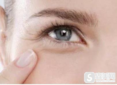 眼尾纹除皱较好的方式是什么?附眼尾纹除皱案例
