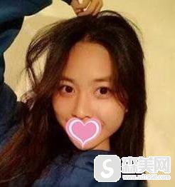 注射微晶瓷隆鼻多少钱?附微晶瓷隆鼻案例分享