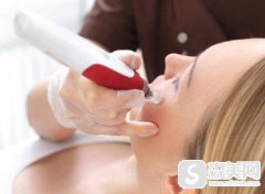 微针去痘坑怎么样?附微针去痘坑案例分享