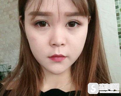 垫鼻子大概需要多少钱?附垫鼻子案例分享