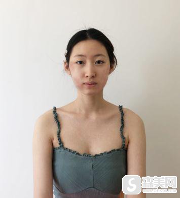 看到了明星金智媛整容前后照片，找到了广州美恩做轮廓