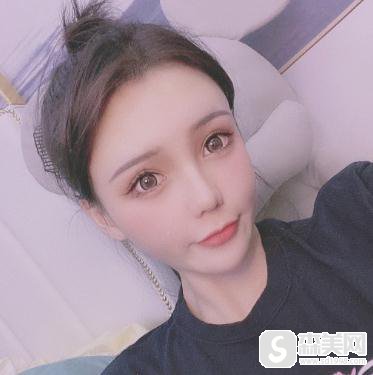 被安利了明星张歆艺整容前后照片,找到了成都八大处丰额头