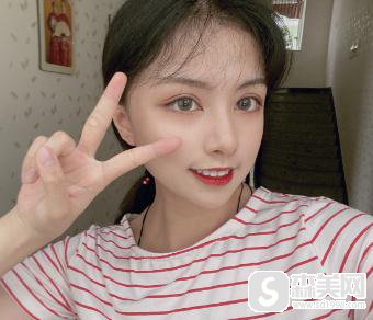 看完了明星贾青整容的照片，找到了杭州格莱美进行双眼皮手术