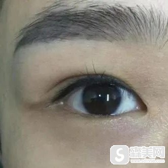 武汉开眼角来赞五洲整形,让你能够获得完美经典的美丽大眼睛!