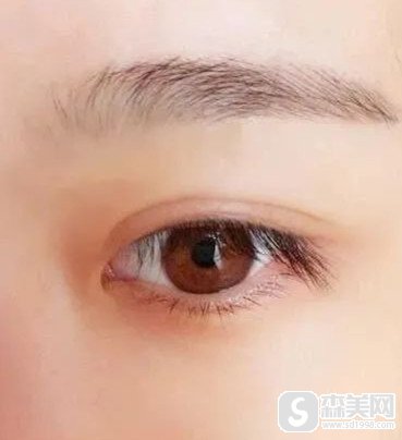 武汉开眼角来赞五洲整形,让你能够获得完美经典的美丽大眼睛!