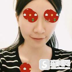 鼻翼过宽缩小整形手术怎么样？附鼻翼缩小手术案例分享