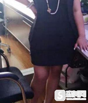 腰部吸脂减肥术的价格以及没问题系数怎么样？附腰部吸脂减肥术前后果图