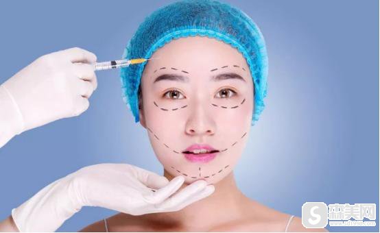 脸部吸脂全过程曝光,附脸部吸脂案例前后果对比图