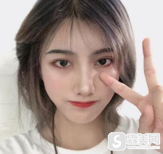 上海九院鼻孔缩小术,附隆鼻恢复详情以及分析