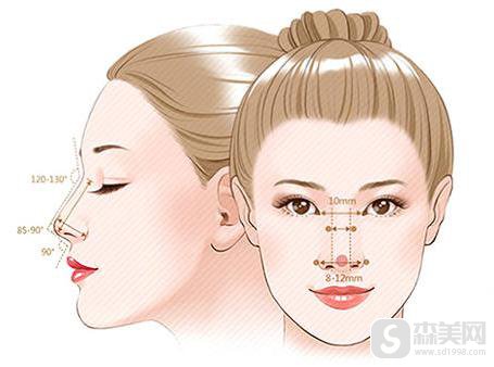假体隆鼻的副作用有哪些？咱们去规避这些副作用，附加假体隆鼻案例分享＋前后果图