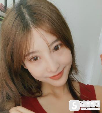 中国人民解放军总医院面部填充案例,附70天恢复详情