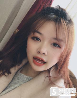 上海华美全切双眼皮恢复过程图，附案例前后照片对比＋2021整形价格浏览