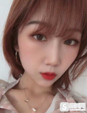 上海九院微创双眼皮恢复过程图，附较新价格表＋双眼皮术后注意问题