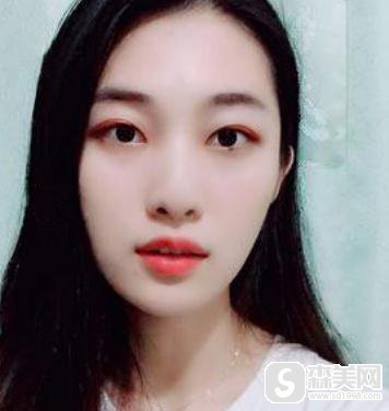 北京协和注射瘦脸整形,附亲身案例详解+注射术后注意事项