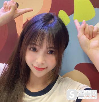 中日友好医院脂肪填充全脸，附恢复详情记录＋填充果