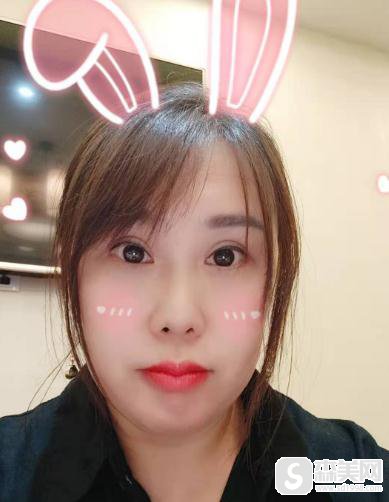 杭州时光激光祛黄褐斑的价格，附案例介绍＋较新价格表展示