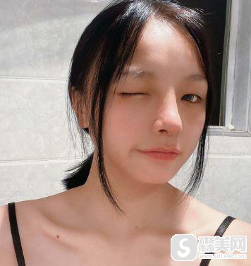 苏州美莱假体隆鼻照片，附真实案例主介＋假体隆鼻具体恢复时间