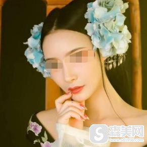 杜若溪整容了么？杜若溪整容揭秘,附真实隆鼻案例+隆鼻前后案例果图