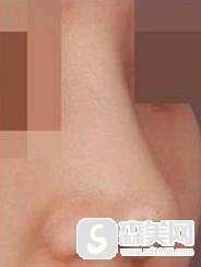 方跃明口碑怎么样?微丽医疗美容机构+口碑如何+专家案例分享!