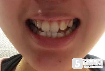 重庆八益牙科怎么样？专家信息揭秘_内附专家案例前后对比！