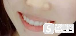 重庆八益牙科怎么样？专家信息揭秘_内附专家案例前后对比！