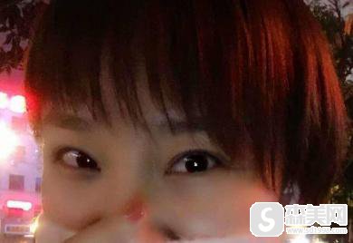 李心艾整容前后对比,附双眼皮案例+前后案例对比图