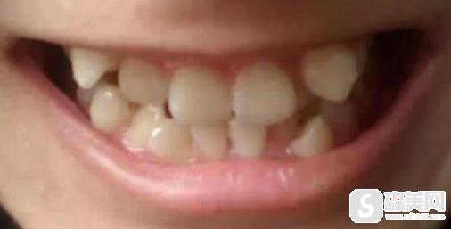上海美联臣口腔诊所怎么样?口碑情况+医生介绍+牙齿矫正案例分享！