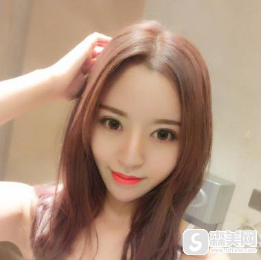 哈尔滨华美双眼皮埋线恢复时间,附案例详情+具体对比照