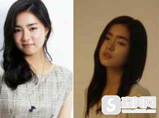 申世京整容前后对比,附下颌骨真实手术案例及果图对比分享!