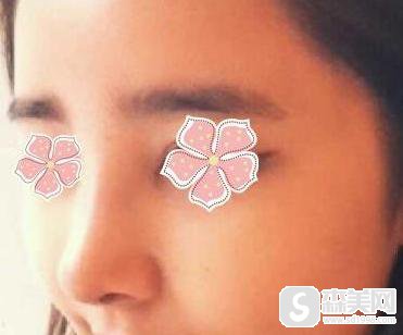 李钟硕整容前后对比,附隆鼻案例分享+隆鼻前后果对比图