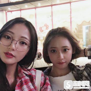 杭州艺星割双眼皮恢复过程图,附2021较新价格表