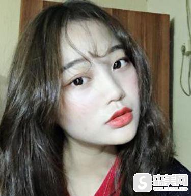 杭州艺星割双眼皮恢复过程图,附2021较新价格表