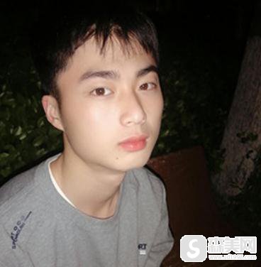 杭州新友好整形美容医院隆鼻做的好吗?附专业隆鼻案例分享