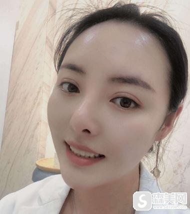 福州牙齿美白整形医院哪家好,福州协和具体案例展示