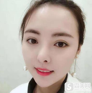 福州牙齿美白整形医院哪家好,福州协和具体案例展示