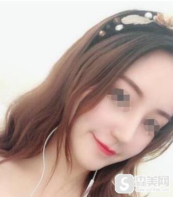 北京中医药大学东方医院整形美容科好不好？口碑情况？附隆鼻案例果！