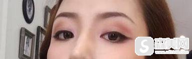 首都医科大学附属北京朝阳医院西院整形外科怎么样？口碑情况+医生介绍+双眼皮案例！