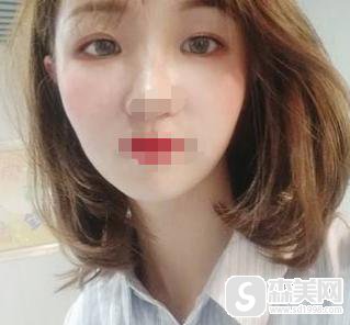 首都医科大学附属北京天坛医院医疗医院好吗？口碑情况+医生介绍+案例展示！