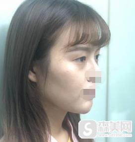 中国医学科学院整形外科医院怎么样？口碑情况+医生介绍+双眼皮案例分享！