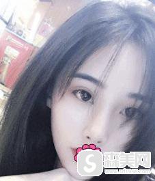 中日友好医院整形外科怎么样?口碑介绍+专家信息介绍+双眼皮案例分享!